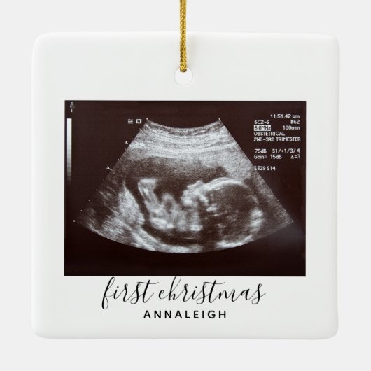 Eerste kerstbevruchting Ultrasound Foto aangepast Keramisch Ornament (Achterkant)