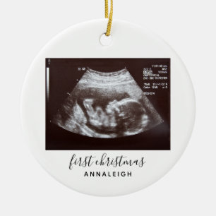 Eerste kerstperiode Ultrasound Baby Scan Keramisch Ornament