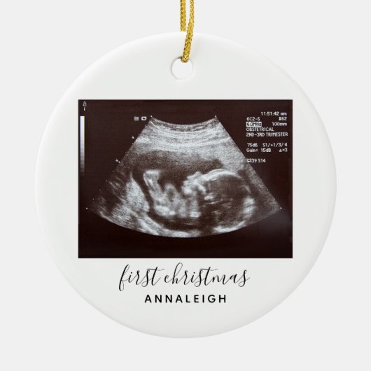 Eerste kerstperiode Ultrasound Baby Scan Keramisch Ornament (Voorkant)