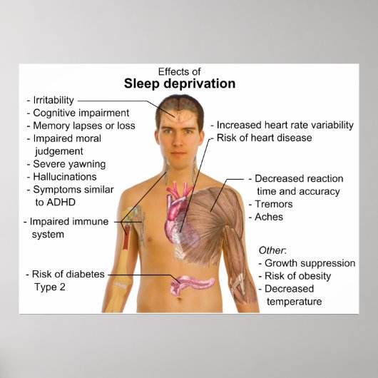 Effecten van slaapaanvallen op het menselijk licha poster (Voorkant)