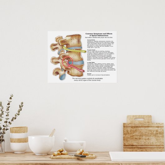 Effecten van Spinale Subluxatie Chiropraktijk Post Poster (Keuken)