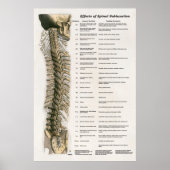 Effecten van Spinale subluxatie Poster Chiroprakti (Voorkant)