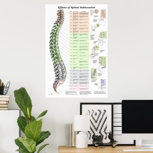 Effecten van Spinale subluxatie Poster Chiroprakti (Thuiskantoor)