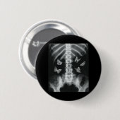 Egirl Skeleton Xray Butterfly Harajuku y2k Dark Ed Ronde Button 5,7 Cm (Voorkant /achterkant)