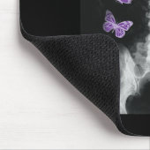 Egirl Xray Skelet Roze Vlinder Harajuku y2k Da Muismat (Hoek)