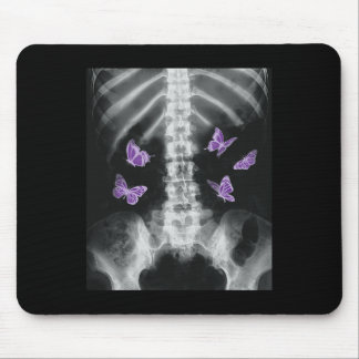 Egirl Xray Skelet Roze Vlinder Harajuku y2k Da Muismat