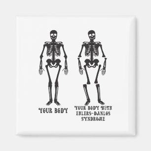 Ehlers - Uw lichaam met Ehlers Danlos Syndroom Awa Magneet