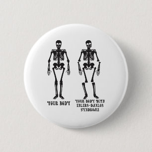 Ehlers - Uw lichaam met Ehlers Danlos Syndroom Awa Ronde Button 5,7 Cm