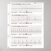 ekg Rhythms Poster (Voorkant)
