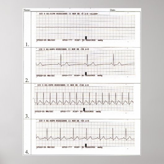 ekg Rhythms Poster (Voorkant)