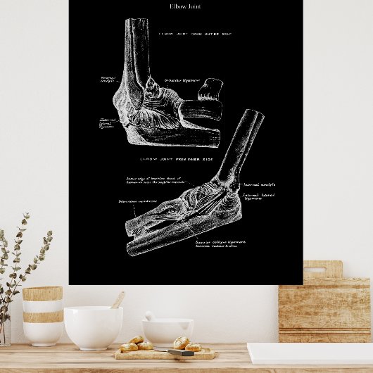 Elbow Joint Anatomy Orthopedic Wall Decor Poster (Keuken)
