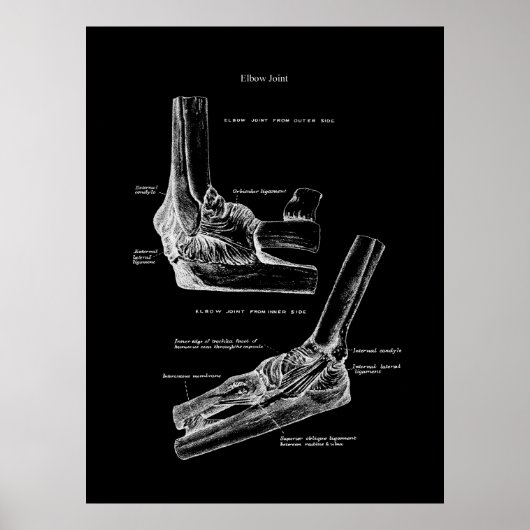 Elbow Joint Anatomy Orthopedic Wall Decor Poster (Voorkant)