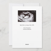 Elegante zwangerschapsaankondiging eenvoudig feestdagenkaart (Achterkant)