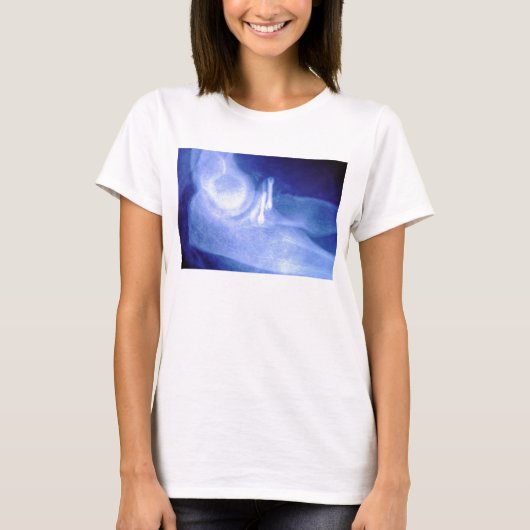 Elleboogstraal met schroeven t-shirt (Voorkant)