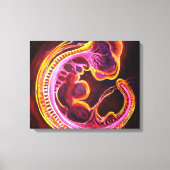 Embryo Canvas Afdruk (Voorkant)