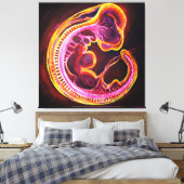 Embryo Canvas Afdruk (Insitu (Slaapkamer))