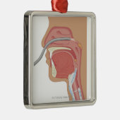 Endoscopie van de neus metalen ornament (Rechts)