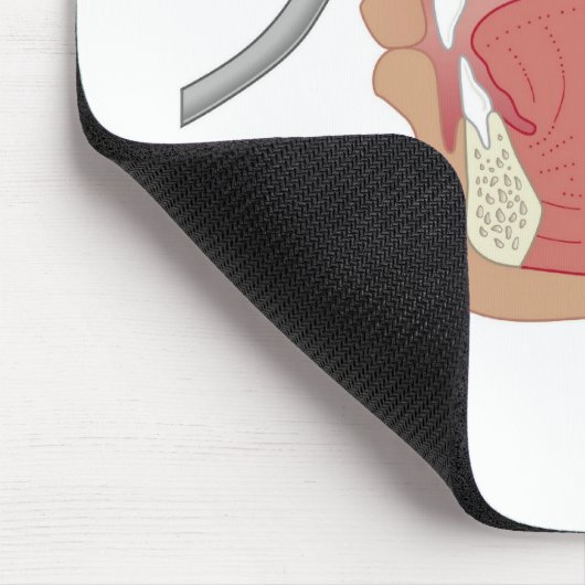 Endoscopie van de neus muismat (Hoek)