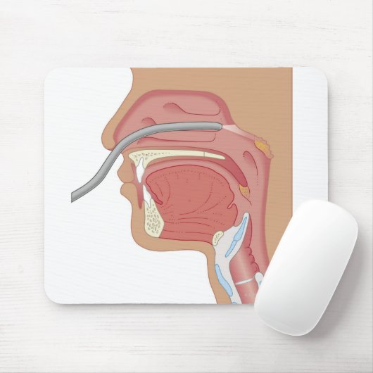 Endoscopie van de neus muismat (Met muis)