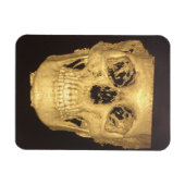 Enge Schedel Magneet (Horizontaal)