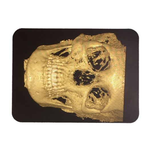 Enge Schedel Magneet (Horizontaal)