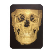 Enge Schedel Magneet (Verticaal)