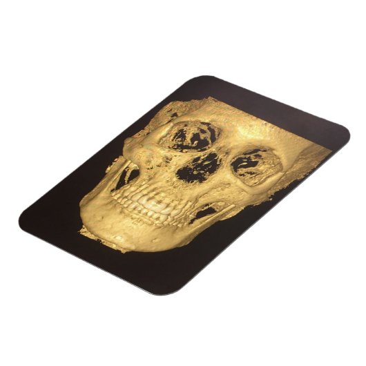 Enge Schedel Magneet (Linkerzijde)