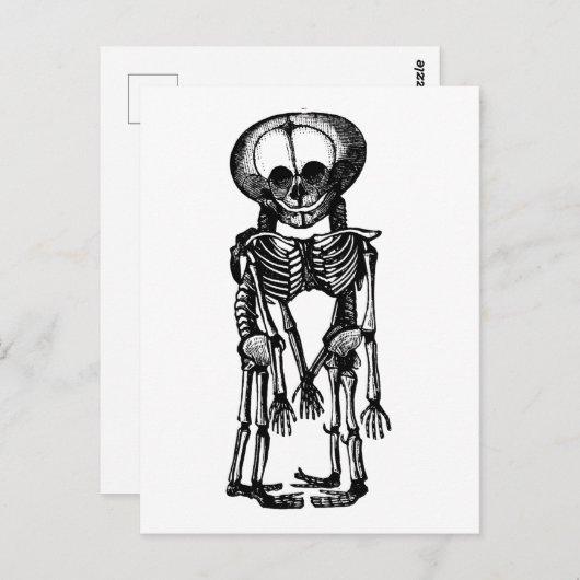 enge siamese tweeling skelet kinder anatomie kunst briefkaart (Voorkant / Achterkant)