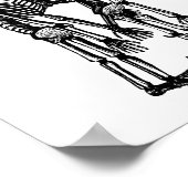 enge siamese tweeling skelet kinder anatomie kunst poster (Hoek)