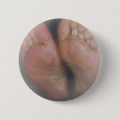 ENKELVOEDINGSBUTTON RONDE BUTTON 5,7 CM (Voorkant)