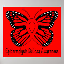 Epidermolysis Bullosa (EB)