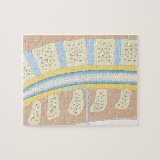 Epidurale anesthesie legpuzzel (Horizontaal)