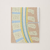 Epidurale anesthesie legpuzzel (Verticaal)