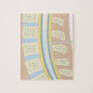 Epidurale anesthesie legpuzzel