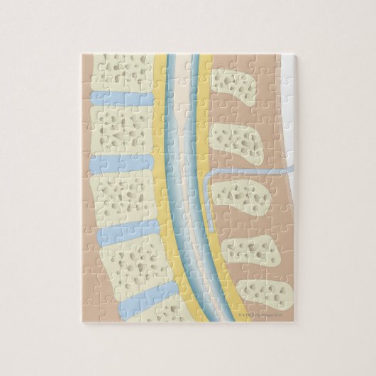 Epidurale anesthesie legpuzzel (Verticaal)