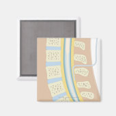 Epidurale anesthesie magneet (Voorkant / Achterkant)