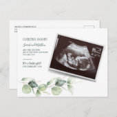 Eucalyptus Sonogram Baby Scan Reveal Pregnancy Aankondigingskaart (Voorkant / Achterkant)