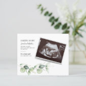 Eucalyptus Zwangerschap Baby (Staand voorkant)