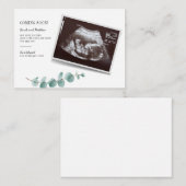 Eucalyptus Zwangerschap Baby Notitiekaartje (Voorkant / Achterkant)