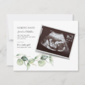 Eucalyptus Zwangerschap Nieuwe mam Baby (Voorkant)