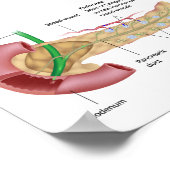 Exocrine- en endocriene alvleesklier, met de verme poster (Hoek)