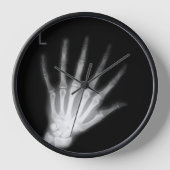 Extra Digit X-ray Left Hand (Voorkant)