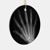 Extra Digit X-ray Left Hand Keramisch Ornament (Rechts)