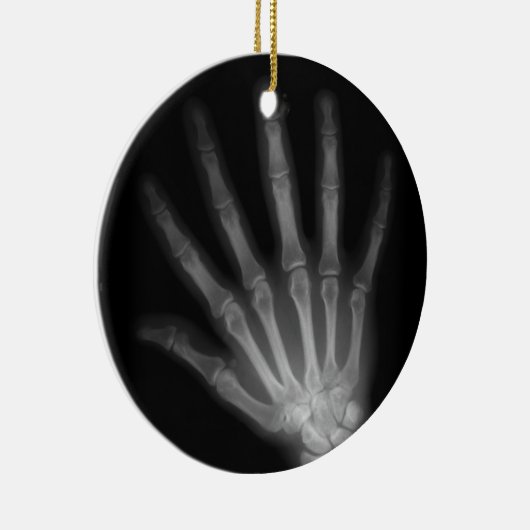 Extra Digit X-ray Left Hand Keramisch Ornament (Rechts)