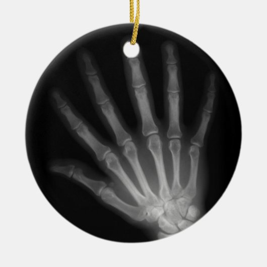 Extra Digit X-ray Left Hand Keramisch Ornament (Voorkant)