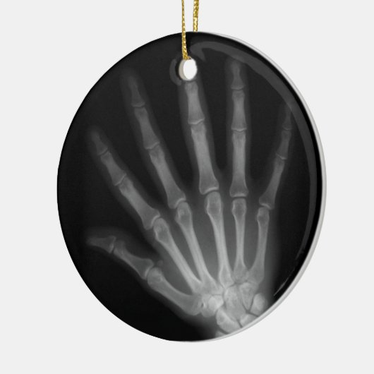 Extra Digit X-ray Left Hand Keramisch Ornament (Links)