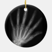 Extra Digit X-ray Left Hand Keramisch Ornament (Achterkant)