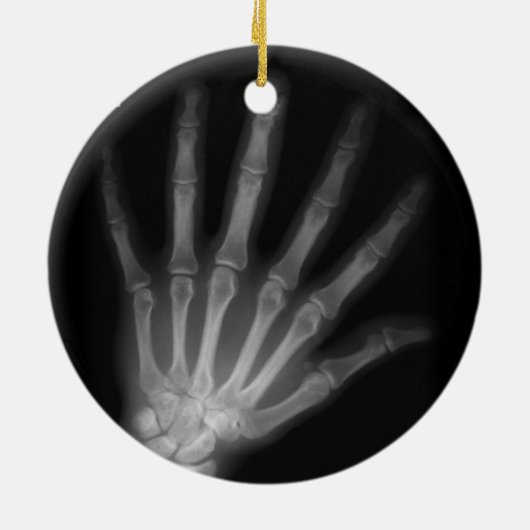 Extra Digit X-ray Left Hand Keramisch Ornament (Achterkant)