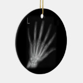 Extra Digit X-ray Left Hand Keramisch Ornament (Rechts)