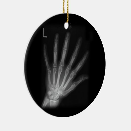 Extra Digit X-ray Left Hand Keramisch Ornament (Rechts)